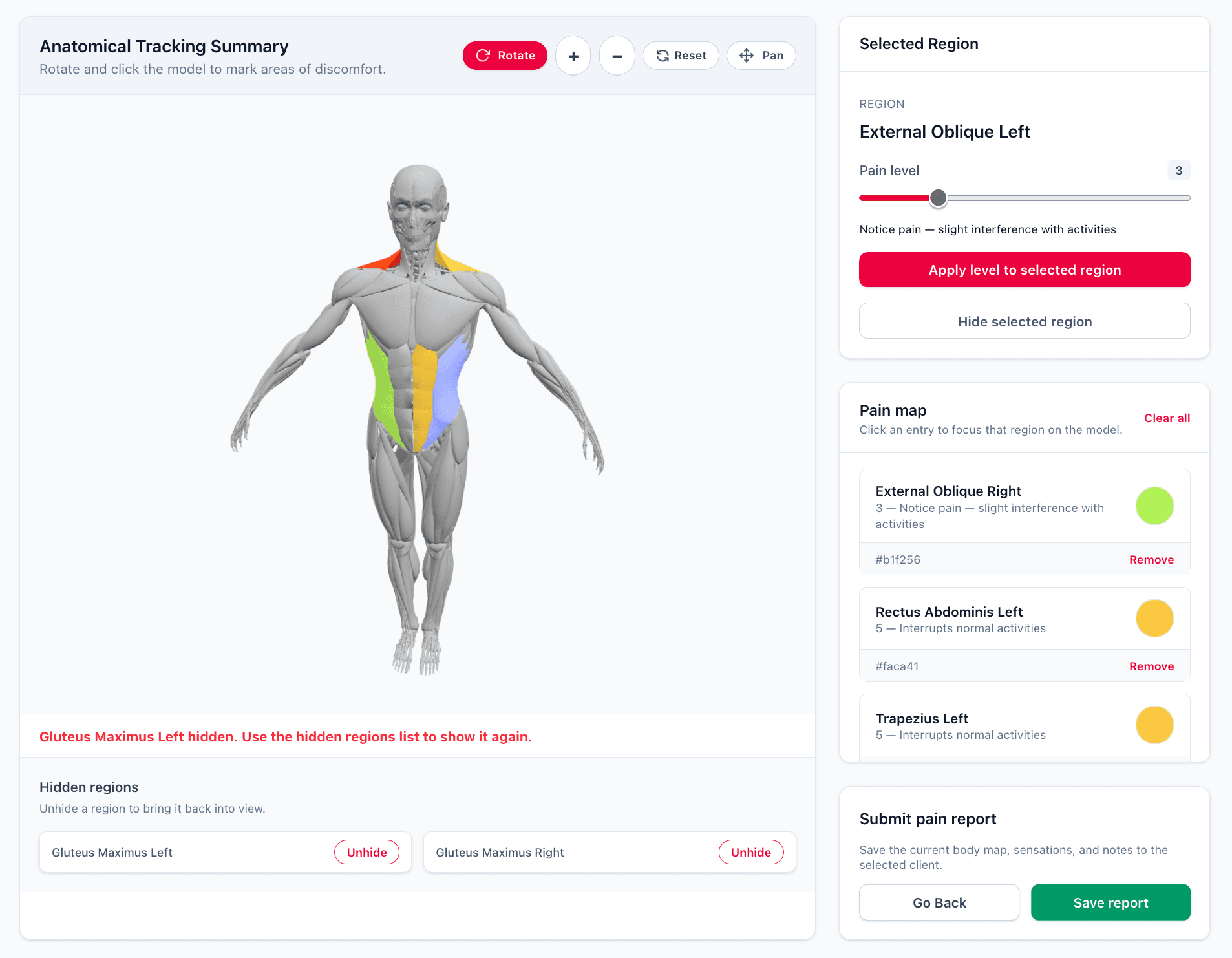 3D Pain Tracking